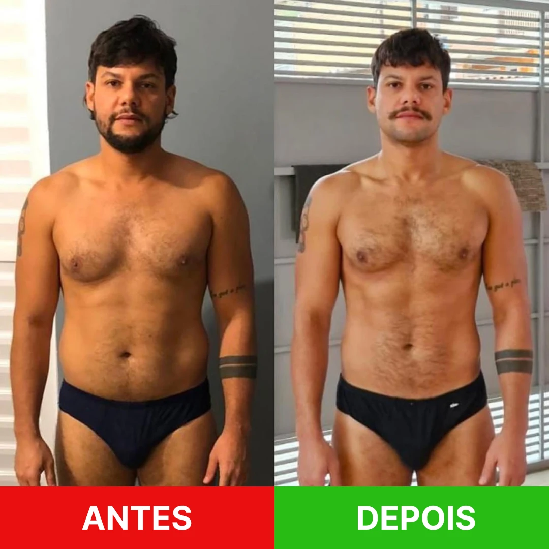 DP allanzem protocolo Gay 2